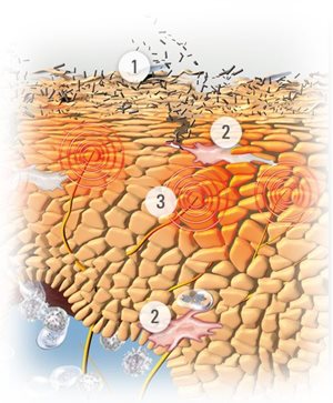 Graphic illustration of skin.